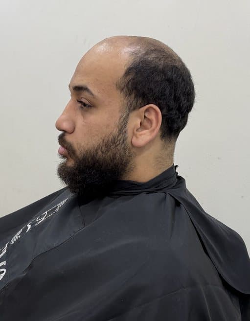 عميل Memo Hair Unit من الجنب